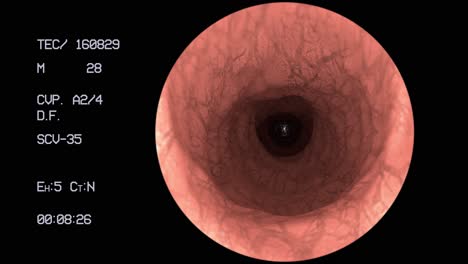 Endoscope-medical-camera-gut-intestine-colon-doctor-endoscopy-surgery-4k